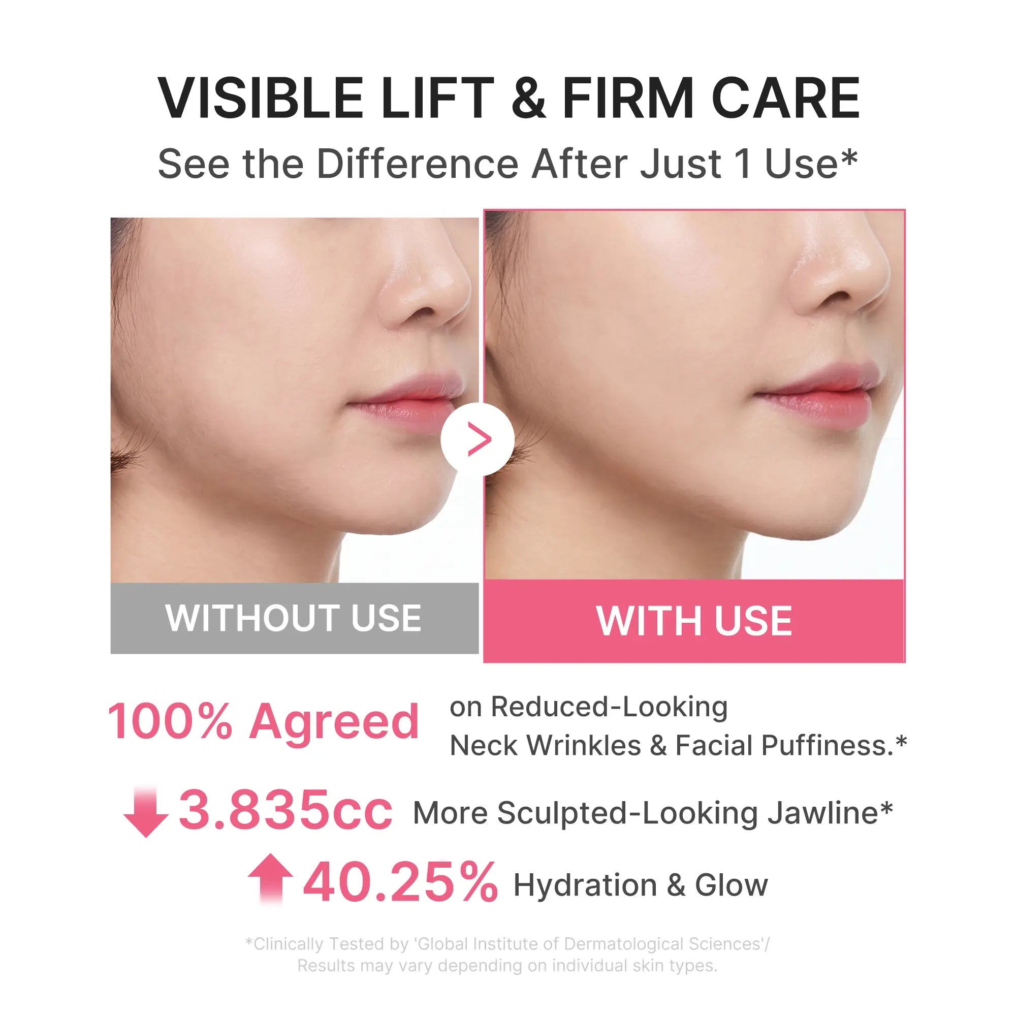 [NEW] [Medicube] PDRN Collagen Gua Sha Neck Wrinkle Cream | Built-In Gua Sha Massager with Volufiline 5% + PDRN | Firming, Contour Care for the Look of Fine Lines, Jawline, Neck, Décolleté | Massage Cream | Korean Skincare
